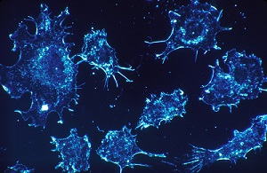 cancer-cells_640