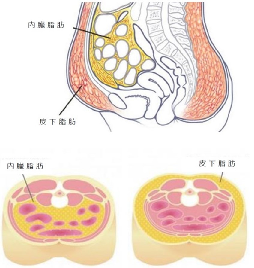 痩身医療ダイエット Jetzt イエット ひろい内科クリニック